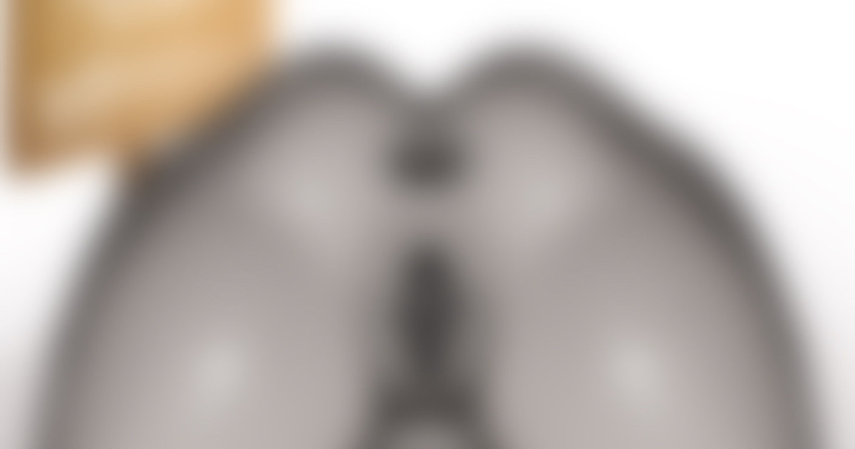 まんぐりがえしの石ベンチにされたデカ尻妻 | エキセントリック鳩美さん